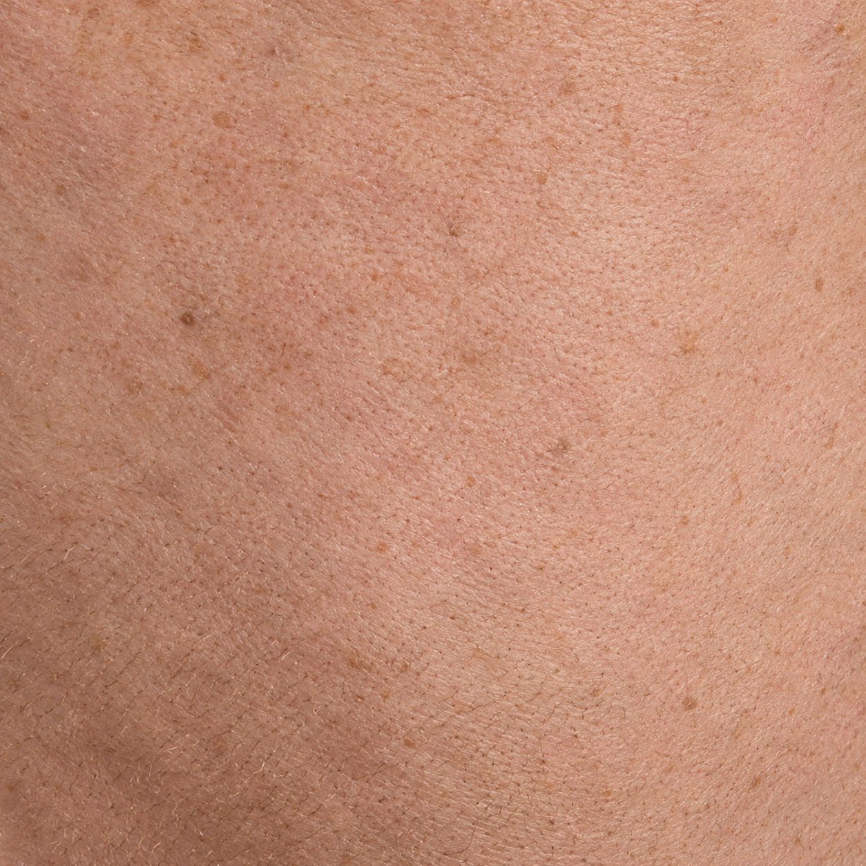 Freckled Human Skin Texture preview showing a natural skin texture